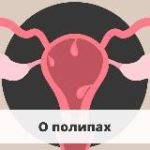 О лечении полипов