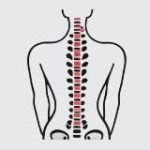 Стоп сутулость и сколиоз. Советы экспертов