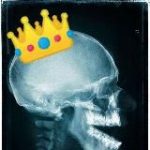 King of radiology