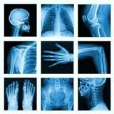 Sólo Radiología (pdf)